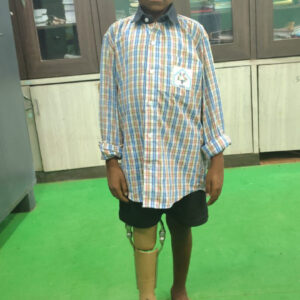 10 साल के कमलेश को मिला कृत्रिम पैर, अब मंजिल की ओर बढ़ेंगे कदम , चिरायु कार्यक्रम की पहल से बदलेगी जिंदगी की राह, अब स्कूल जाने और आगे बढ़ने का बढ़ेगा आत्मविश्वास