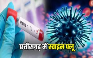 छत्तीसगढ़ के 19 जिलों में फैला स्वाइन फ्लू H1N1, रायपुर में बढ़ते मरीजों से स्वास्थ्य विभाग अलर्ट