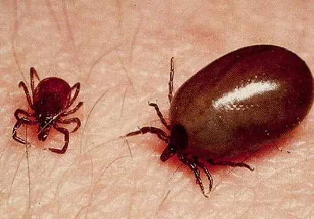 scrub typhus